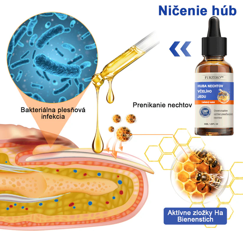Bee Venom for Nail Fungus: A Complete Solution to Nail Fungus & Growth (BUY 1 GET 1 FREE)